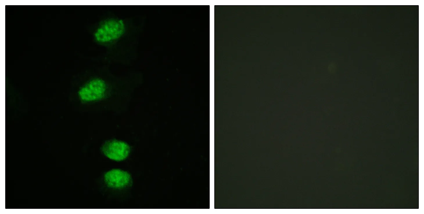 Phospho-AR (Ser94) Rabbit Polyclonal Antibody
